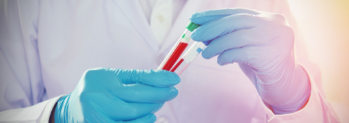 בדיקת חומצה 5 הידרוקסאינדולאצטית בדם (Hydroxyindoleacetic Acid 5-HIA), ובקצרה - חומצת 5-HIAA - תמונה